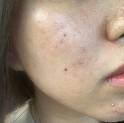 アミノモイスト トライアルセット/ミノン/トライアルキットを使ったクチコミ(1枚目)