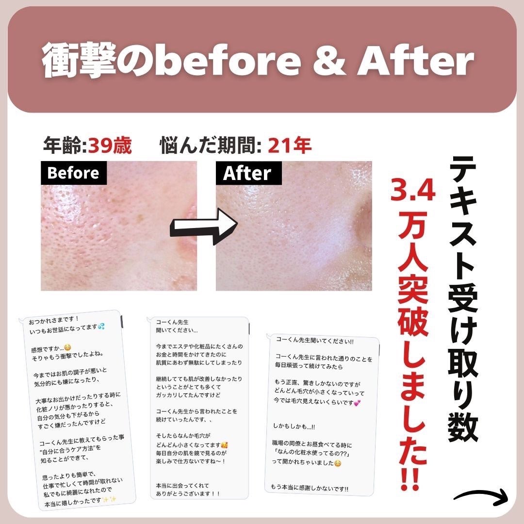 あなたの肌に合ったスキンケア💐コーくん先生 on LIPS 「【9割が知らない】最速で毛穴を消す方法🤫..あなたの毛穴の開き..」(8枚目)