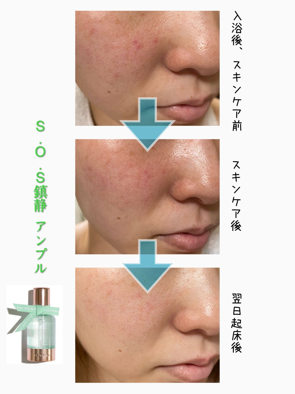 マデカソサイドリペアアンプル/VELY VELY/美容液を使ったクチコミ(6枚目)