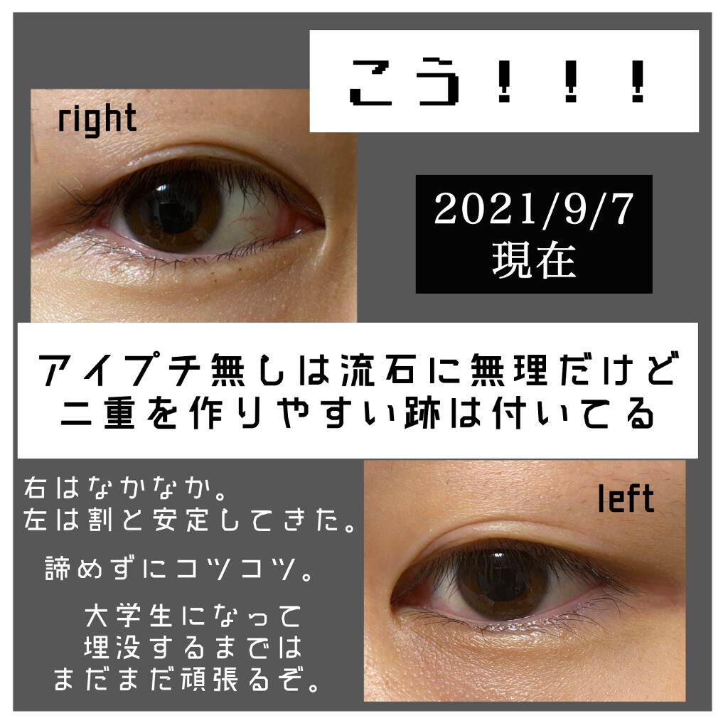 ワンダーアイリッドテープ Extra/D-UP/二重まぶた用アイテムを使ったクチコミ（3枚目）