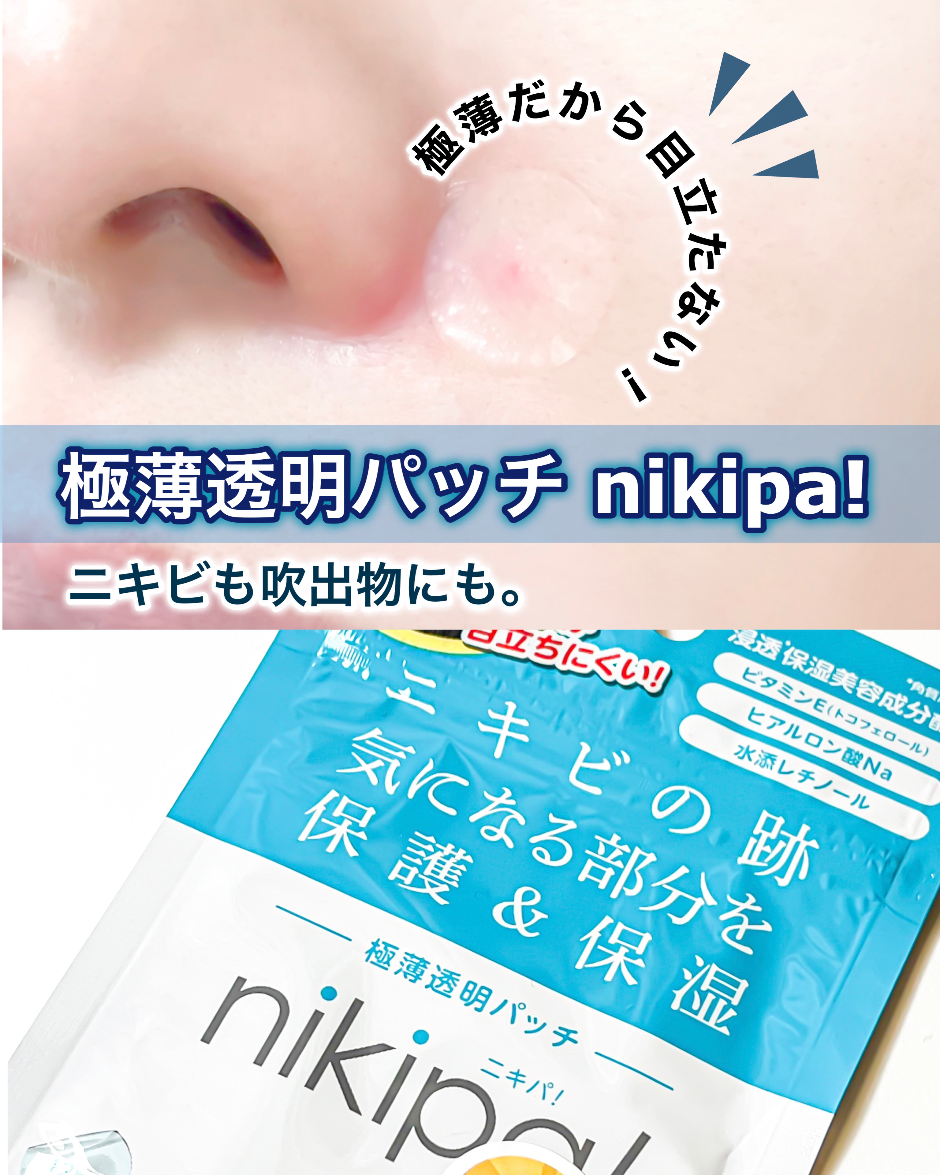 極薄透明パッチ nikipa!/金冠堂/にきびパッチを使ったクチコミ（1枚目）