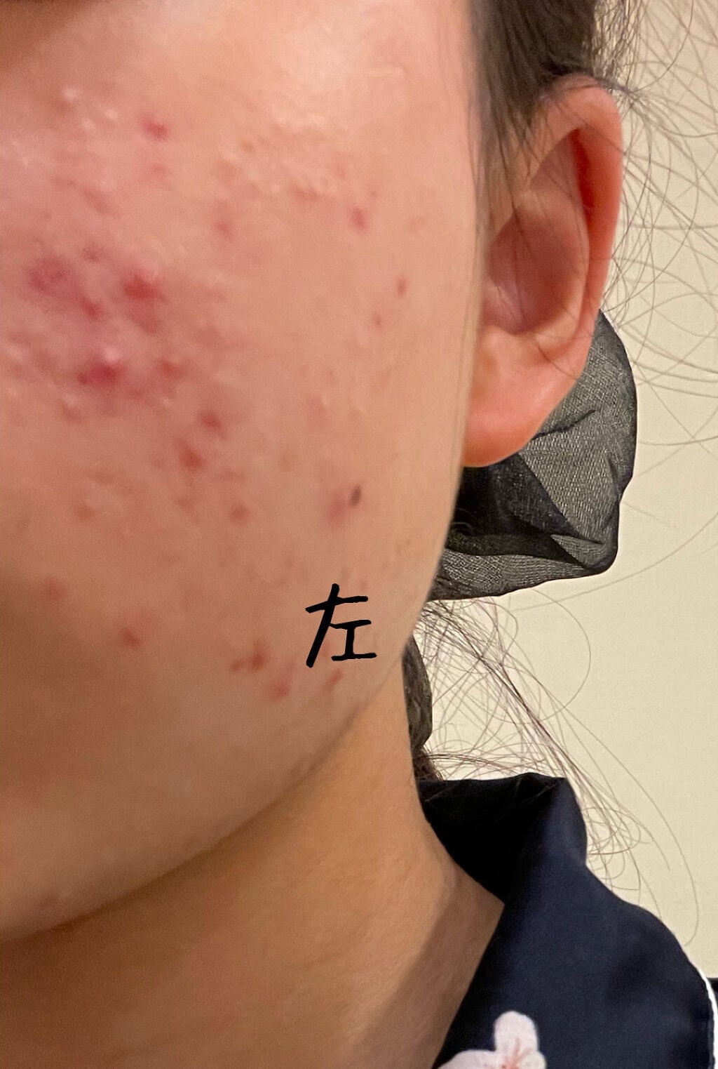 KINNGYOchanâð€ on LIPS ãä¹
ãã¶ãã§ã(˶ËË˶)/ååã®æçš¿ãšæ¯ã¹ããšâŠ(Õ..Õ)"..ãïŒ2æç®ïŒ