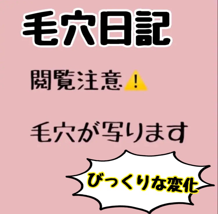 レチノール　シカ　リペア　セラム/innisfree/美容液を使ったクチコミ（1枚目）