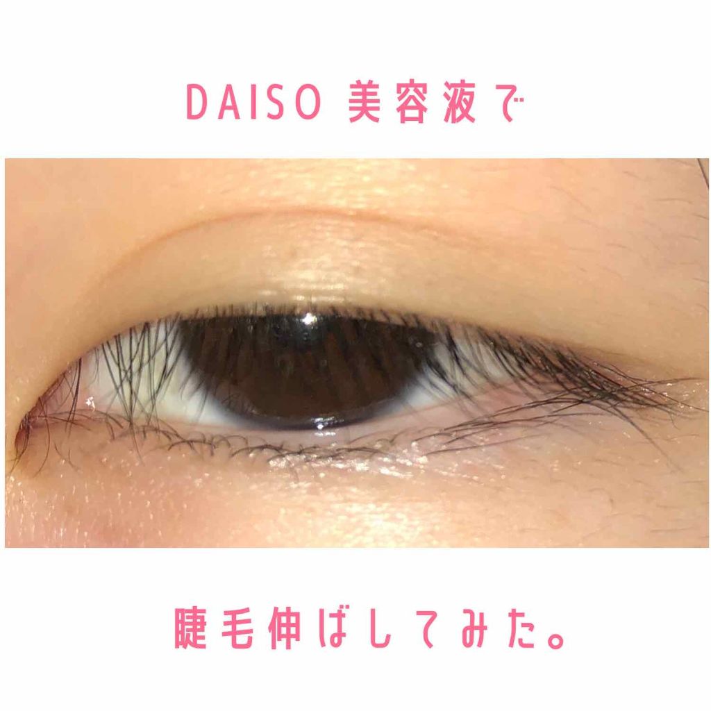 ローヤルゼリー配合 栄養ローション/DAISO/美容液を使ったクチコミ(1枚目)