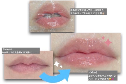 【旧】ディオール アディクト リップ マキシマイザー/Dior/リップグロスを使ったクチコミ(2枚目)