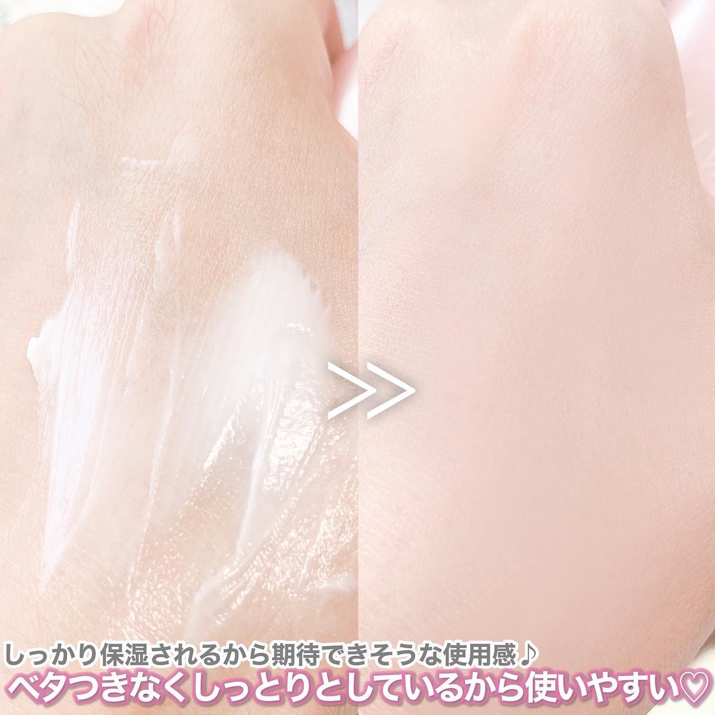 薬用ホワイトケアクリーム/DELIWHITE/デリケートゾーンケアを使ったクチコミ(4枚目)