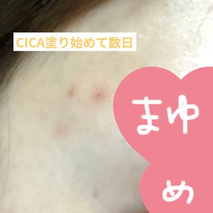 CICA クリーム/VT/フェイスクリームを使ったクチコミ(4枚目)