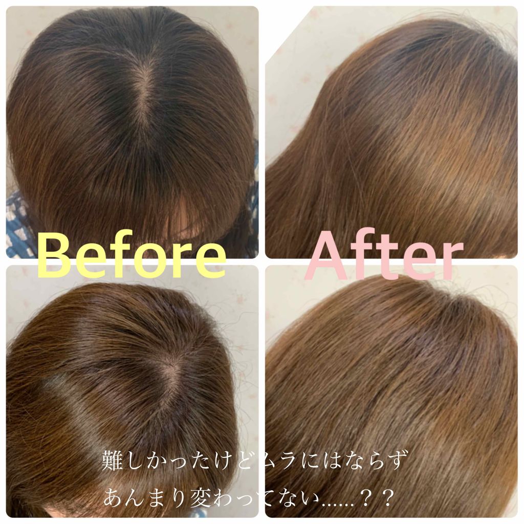 エブリ ヘアカラー アンナドンナの口コミ トリートメントコーティング成分でセルフカラ By いつか 正直レビュー 混合肌 代後半 Lips エブリ ヘアカラー アンナドンナの口コミ トリートメントコーティング成分でセルフカラ By いつか 正直レビュー 混合肌 代後半 Lips