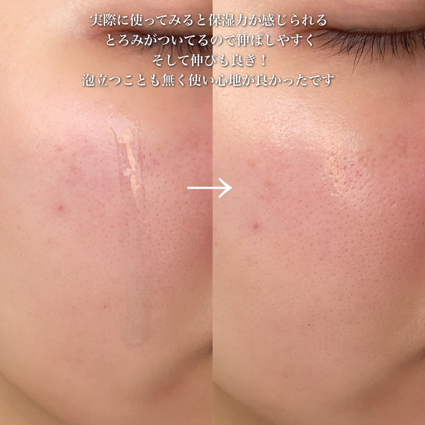 ポアゼロクリアジェル/BRTC/ピーリングを使ったクチコミ(8枚目)