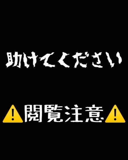 明色美顔水 薬用化粧水/美顔/化粧水を使ったクチコミ(1枚目)