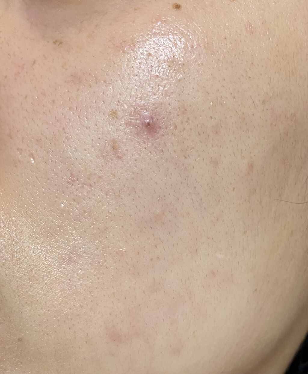 ティーツリーケアソリューション アンプルマスクJEX/MEDIHEAL/シートマスク・パックを使ったクチコミ（2枚目）