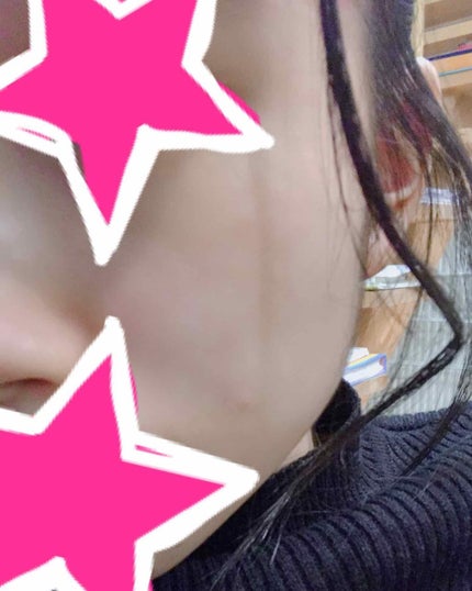 ヒアルロン酸原液/太陽のアロエ社/美容液を使ったクチコミ(2枚目)