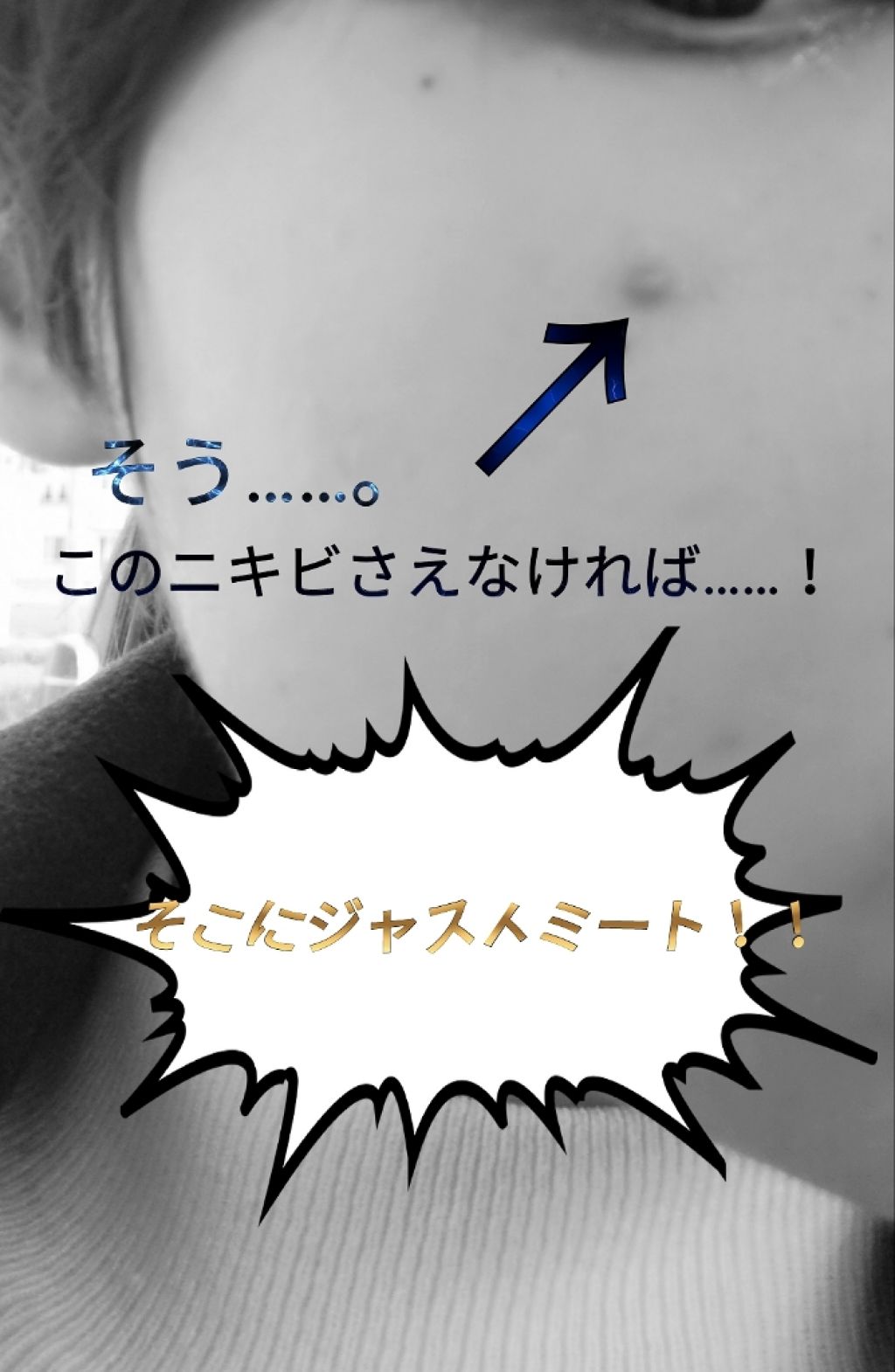 FDR アクネケア エッセンス/ファンケル/美容液を使ったクチコミ（1枚目）