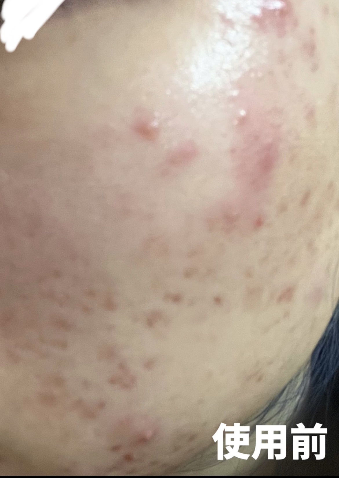 クリアフル トライアルセット L/オルビス/トライアルキットを使ったクチコミ（2枚目）