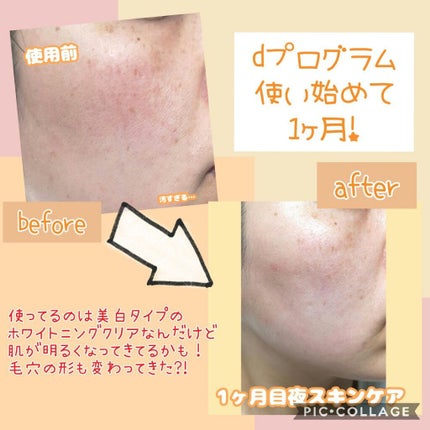 ホワイトニングクリア ローション/d プログラム/化粧水を使ったクチコミ(1枚目)
