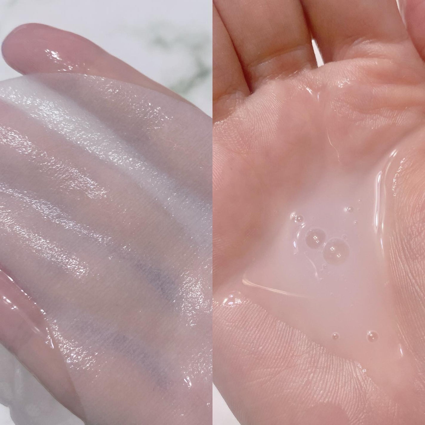 アクネウォッシュ23アンプル/Feld Apotheke/美容液を使ったクチコミ(5枚目)