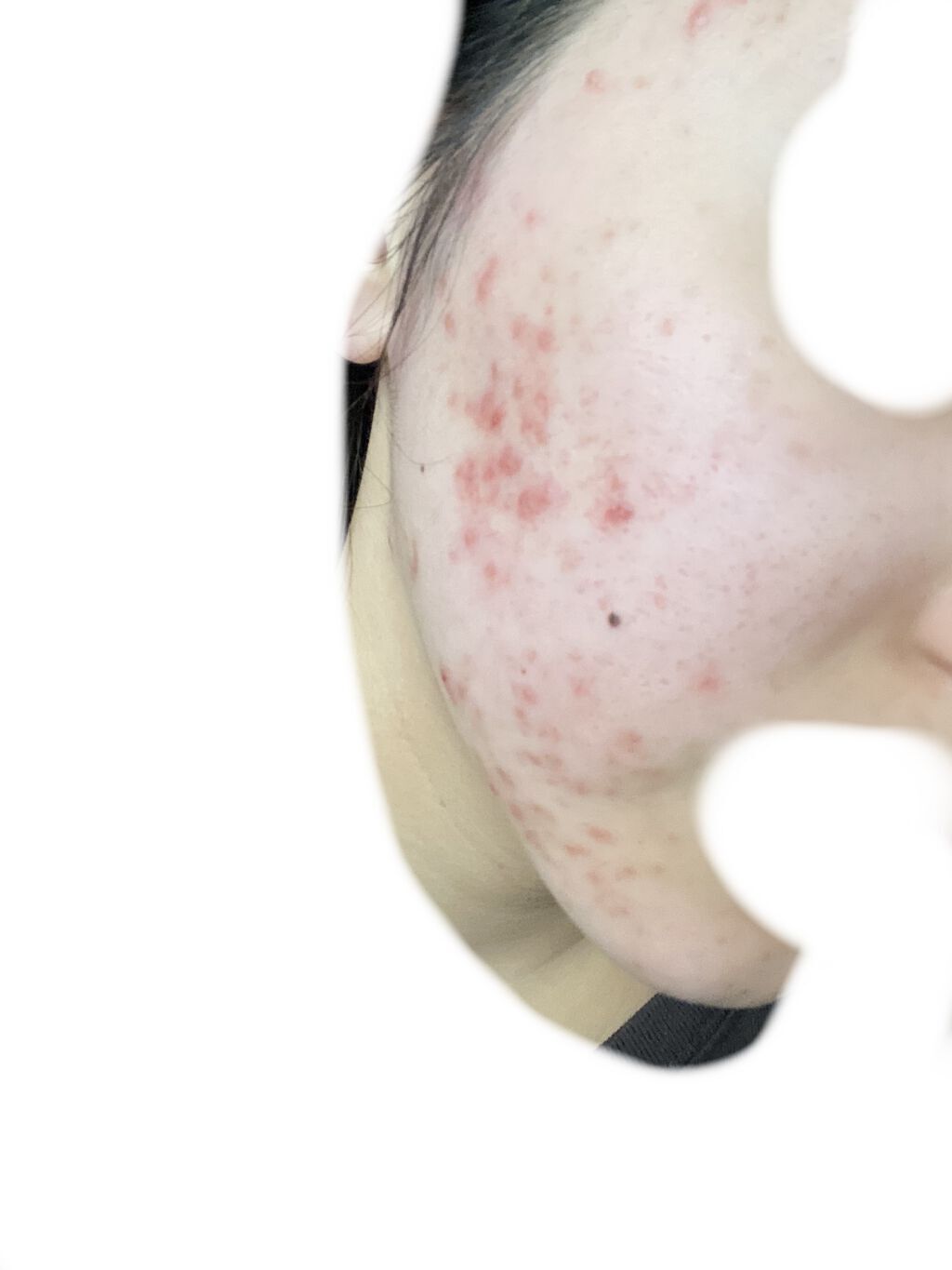 ウォーターヴェール/アクアヴィーナス/化粧水を使ったクチコミ（3枚目）