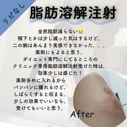 ðððð€ËË on LIPS ããªãããã»ãªããªãçŸå®¹å»çâ»éžïŒã³ããçŠãæããŠçŸå®¹å»çã«ã..ãïŒ7æç®ïŒ