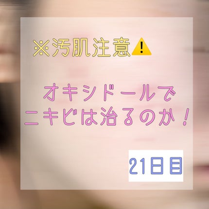 オキシドール(医薬品)/日本薬局方/その他を使ったクチコミ(1枚目)