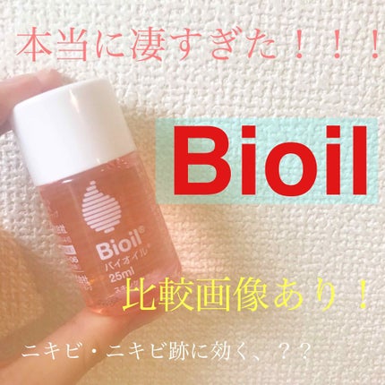 バイオイル/バイオイル/フェイスオイルを使ったクチコミ(1枚目)