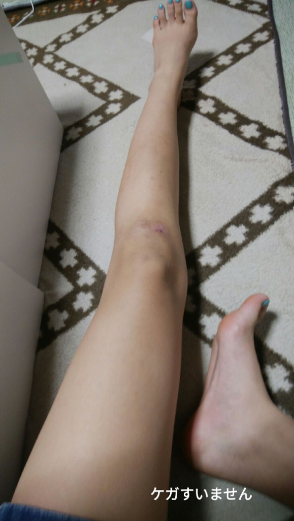 ニベアクリーム/ニベア/ボディクリームを使ったクチコミ（2枚目）