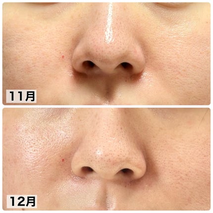 &be クレイウォッシュ/&be/洗顔フォームを使ったクチコミ(2枚目)