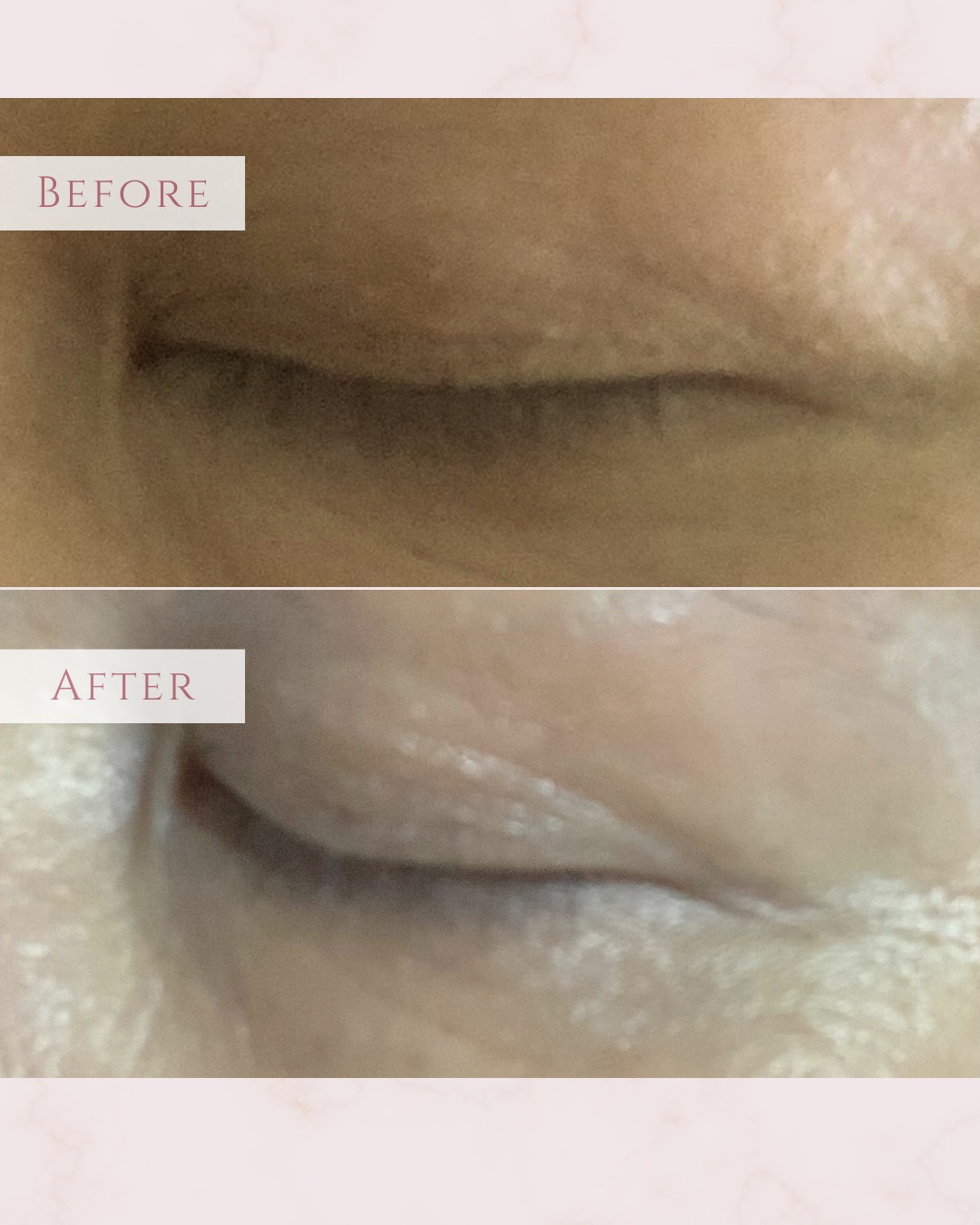 アイラッシュセラム/VIYEUX/まつげ美容液を使ったクチコミ（3枚目）