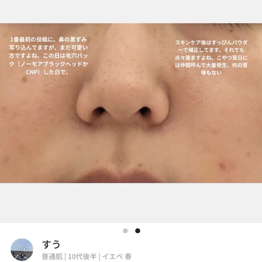 アクアローション (さっぱり・しっとり) トライアル さっぱり/アクアレーベル/化粧水を使ったクチコミ（3枚目）