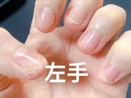 ネイルサポート Na/ネイルネイル/ネイルトップコートを使ったクチコミ(2枚目)