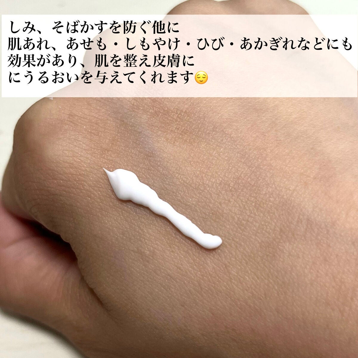 ケシミンクリーム f/ケシミン/フェイスクリームを使ったクチコミ(2枚目)