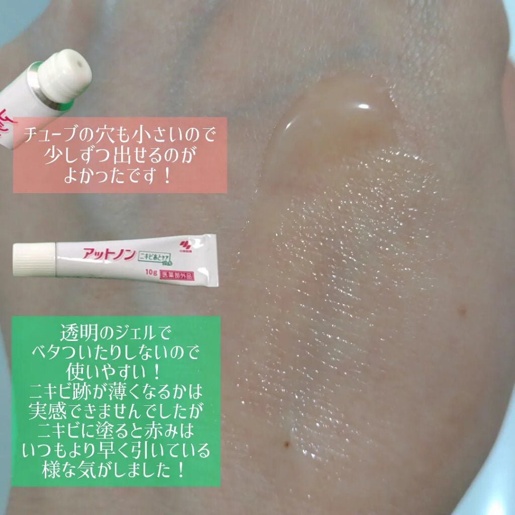 ニキビあとケアジェル/アットノン/その他スキンケアを使ったクチコミ(2枚目)