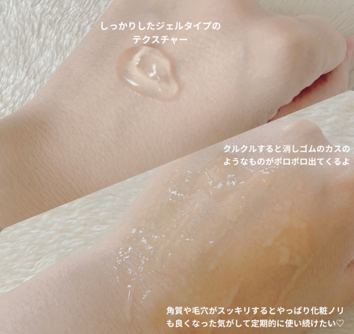 ヒーリンピーリンプロスペックピーリングジェル/素数/ボディスクラブを使ったクチコミ（2枚目）