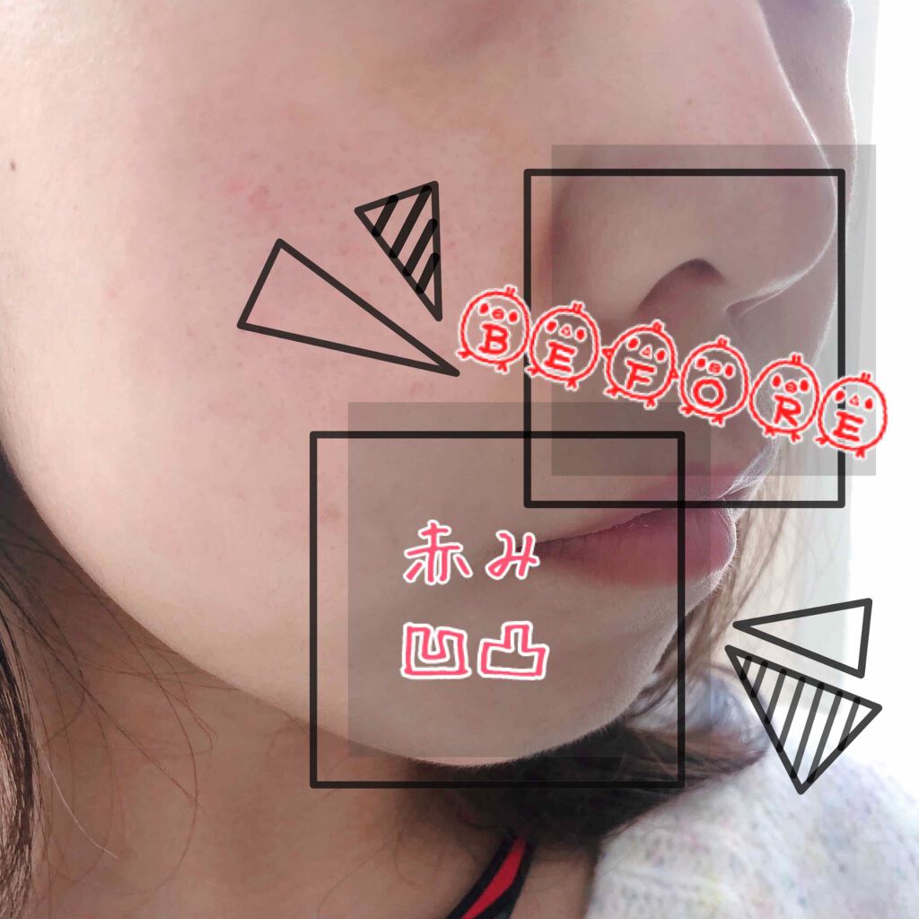 タン イドル ウルトラ クッションコンパクト/LANCOME/クッションファンデーションを使ったクチコミ(2枚目)