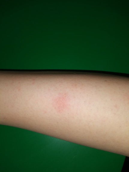 除毛クリームキット(トリートメントEX配合)/エピラット/除毛クリームを使ったクチコミ(3枚目)