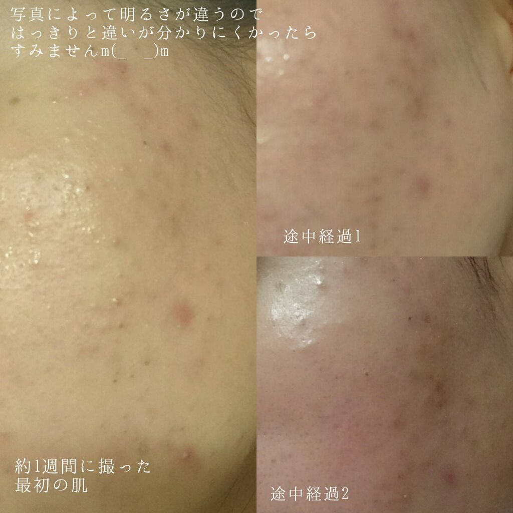 DHC マルチビタミン/DHC/美容サプリメントを使ったクチコミ（2枚目）