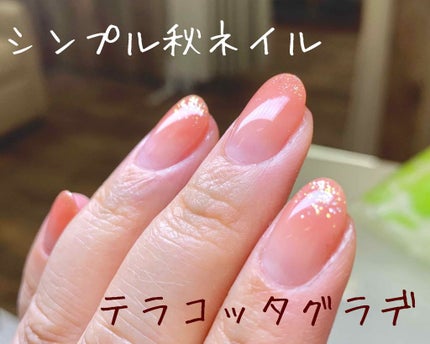 Miku on LIPS 「初投稿♡ネイリストです₍₍(๑॔˃̶◡ ˂̶๑॓)◞♡今回の#..」(1枚目)