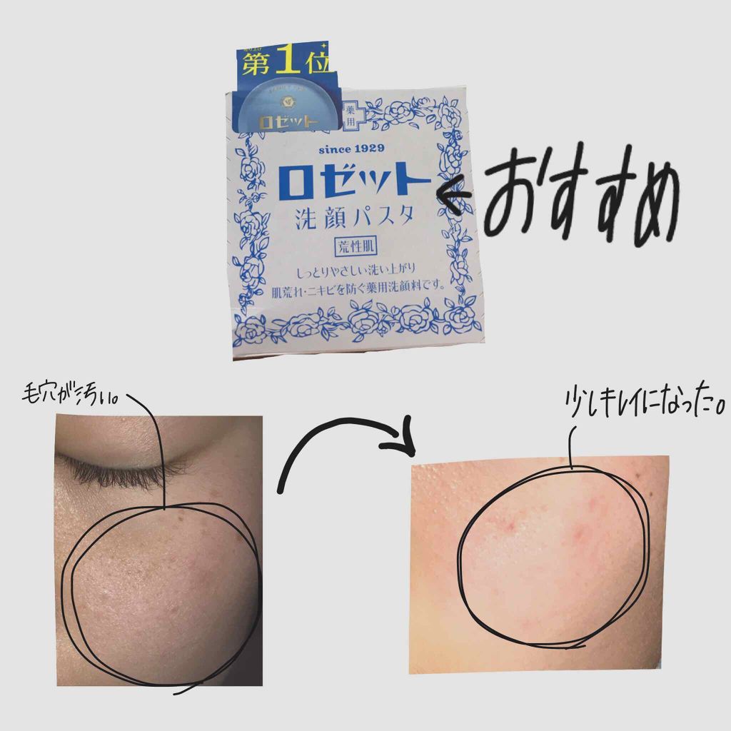ロゼット 洗顔パスタ 荒性肌/ロゼット/洗顔フォームを使ったクチコミ(1枚目)