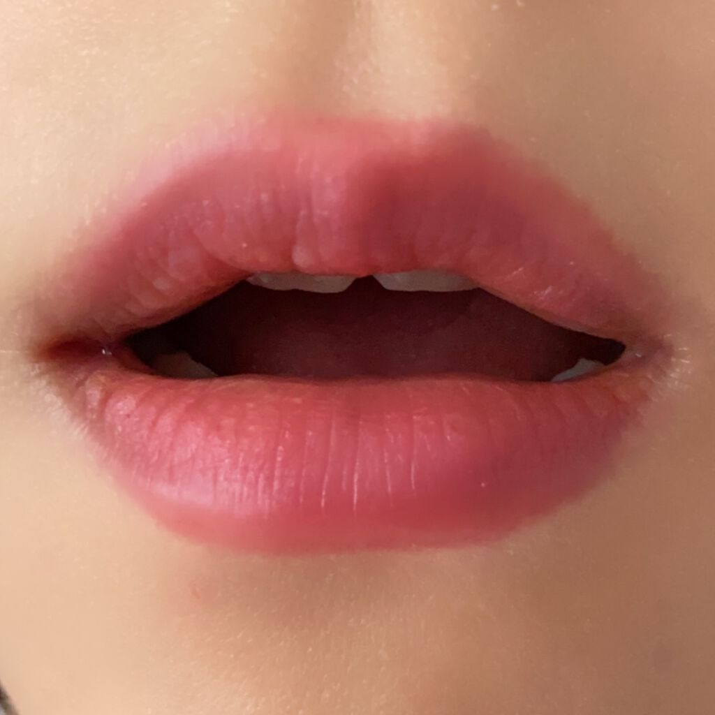 スキューズミー ミゼルエディリップケアプランパー/ミゼルエディ/リッププランパーを使ったクチコミ（2枚目）