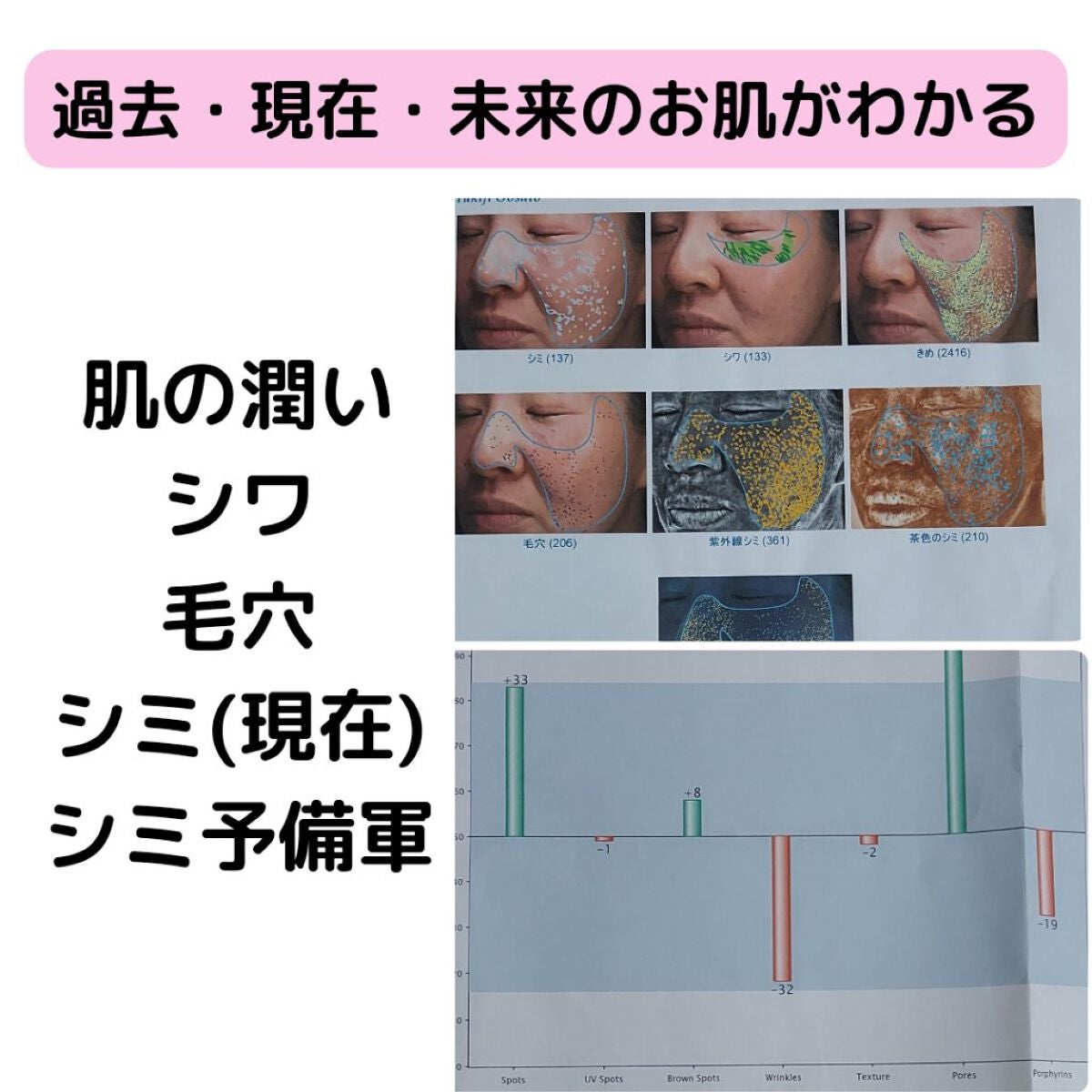 美肌カウンセラー💆肌悩みを解決し見る世界を変える on LIPS 「お肌の成績表👑1つ前の動画の内容を詳しく説明していきます!マシ..」(5枚目)
