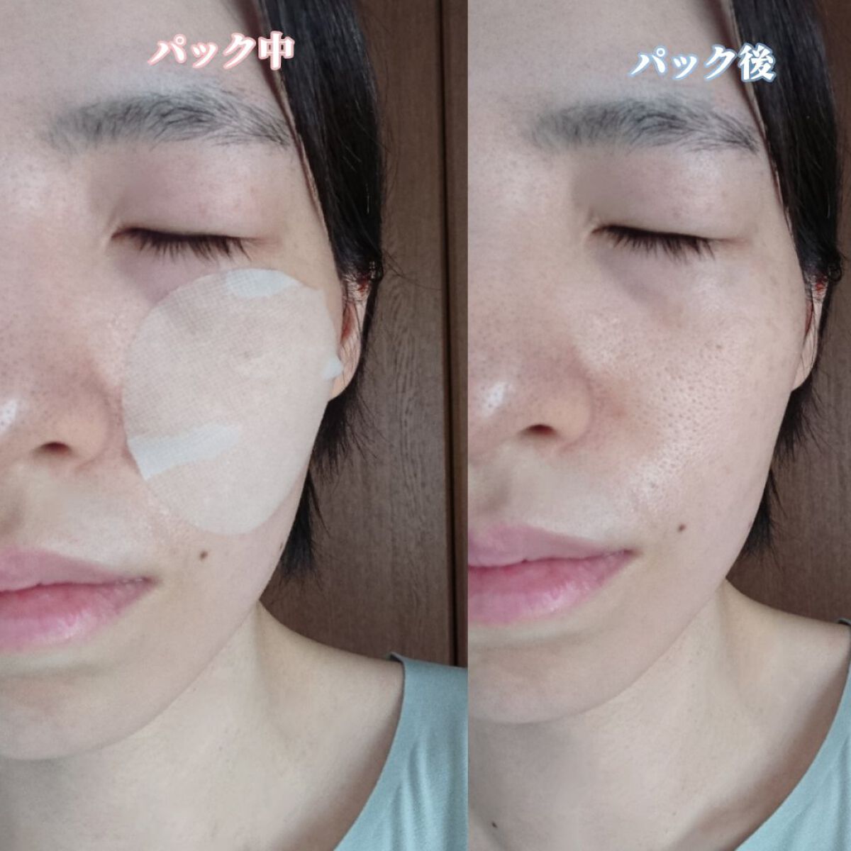 シカゴ― シカスピーディー カーミングパッド/ISOI/トナーパッドを使ったクチコミ(6枚目)