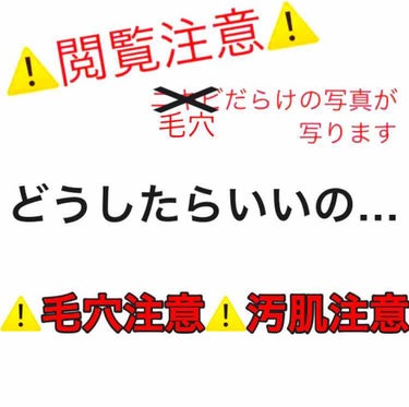 ハトムギ化粧水(ナチュリエ スキンコンディショナー R )/ナチュリエ/化粧水を使ったクチコミ（1枚目）