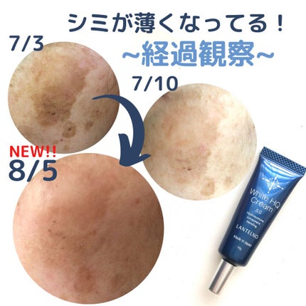WhiteHQCream(ホワイトエイチキュークリーム)/LANTELNO/フェイスクリームを使ったクチコミ(1枚目)