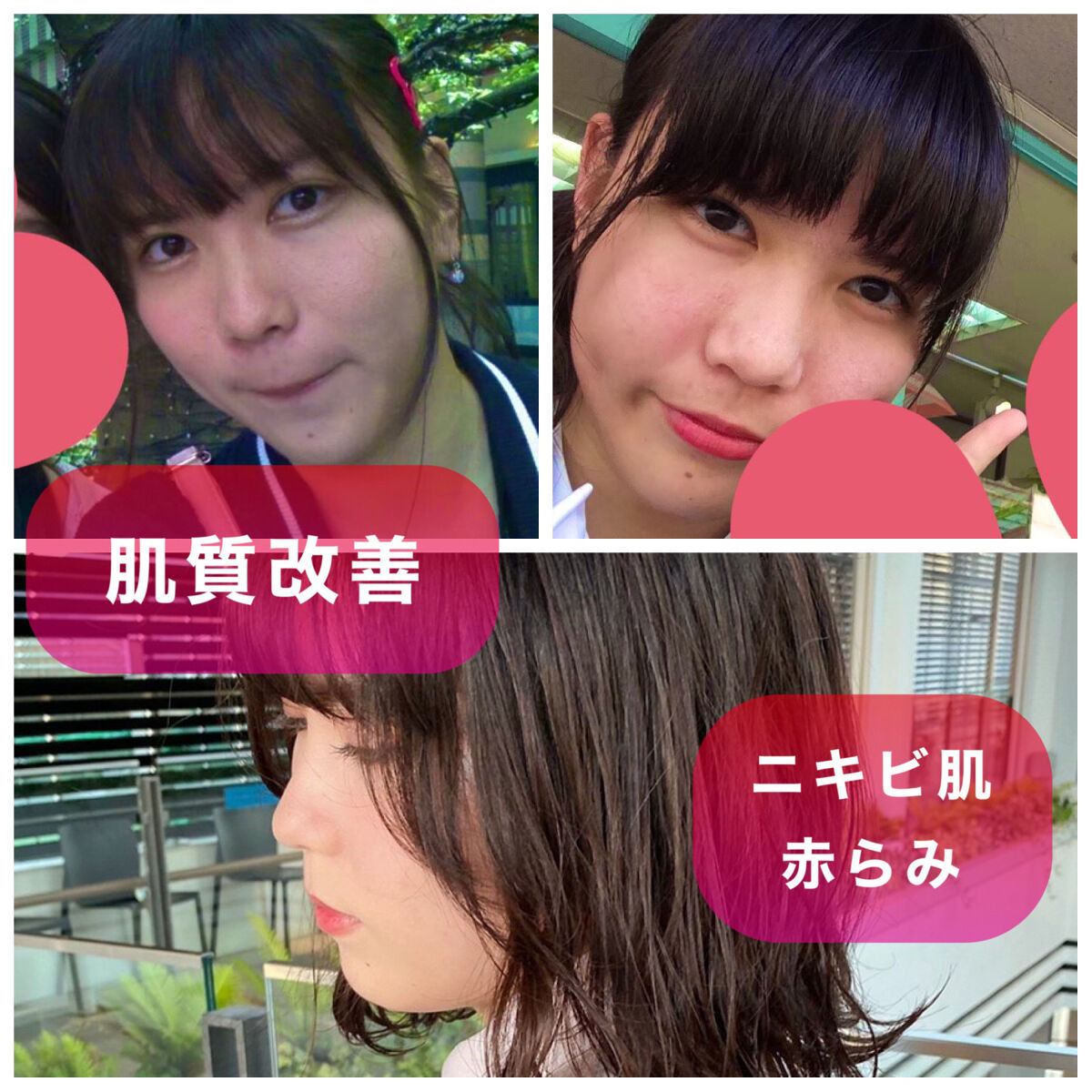 薬用 しみ 集中対策 美容液/メラノCC/美容液を使ったクチコミ（1枚目）