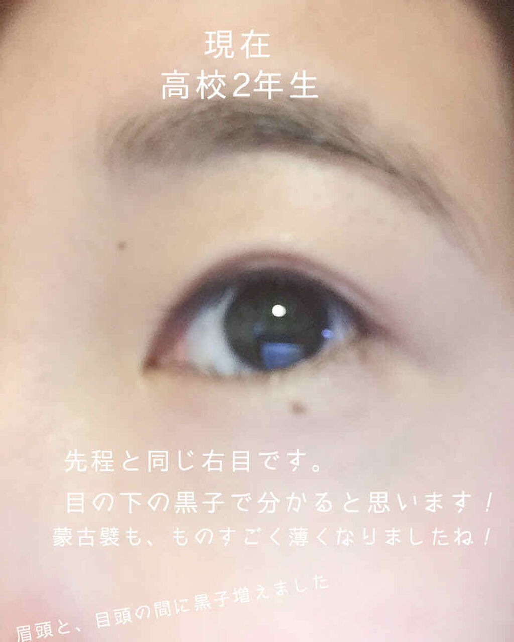 ダブルアイリキッド/Automatic Beauty/二重まぶた用アイテムを使ったクチコミ（3枚目）