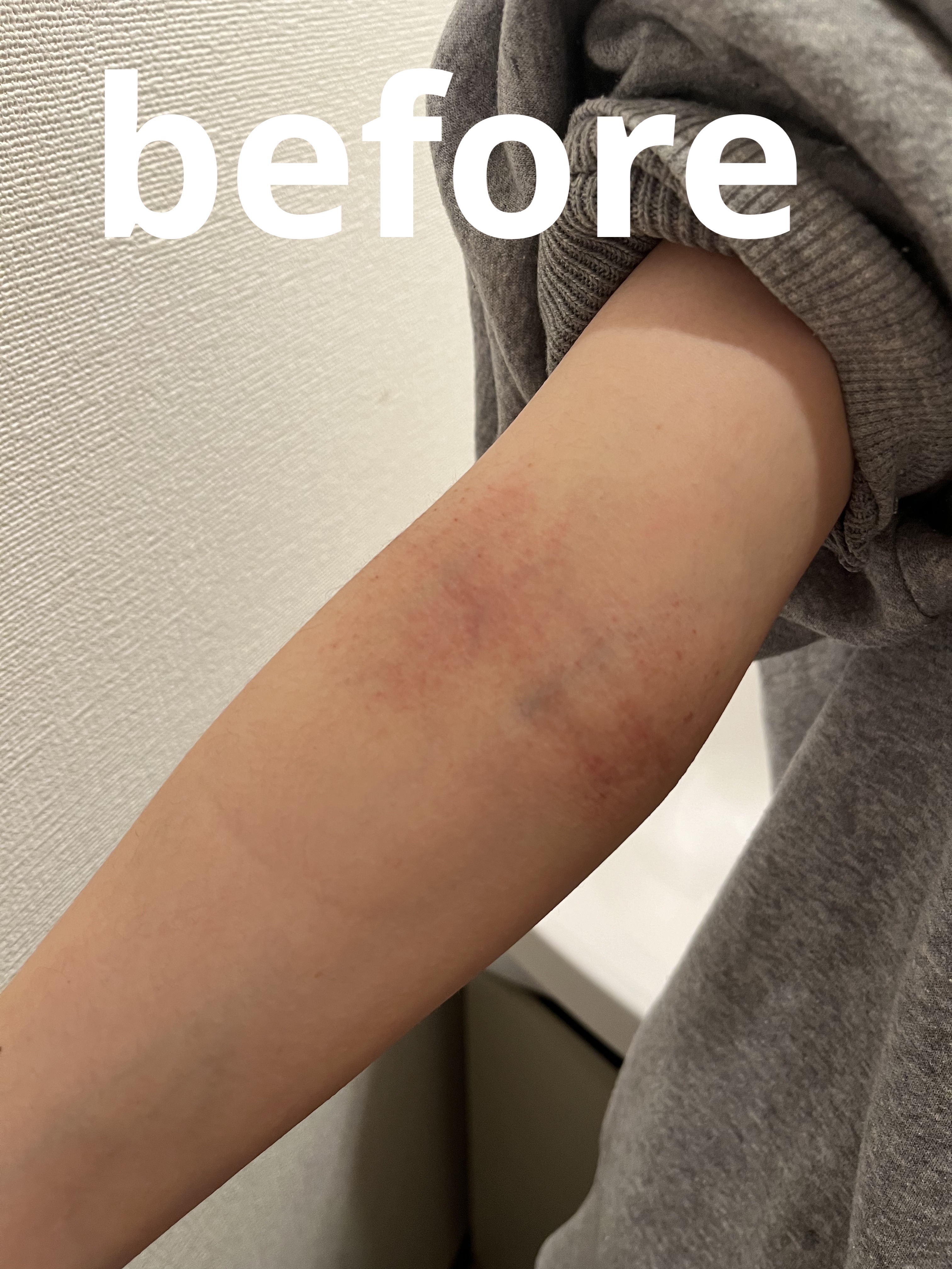 ピュア センテラ トナー/アレンシア/化粧水を使ったクチコミ（1枚目）