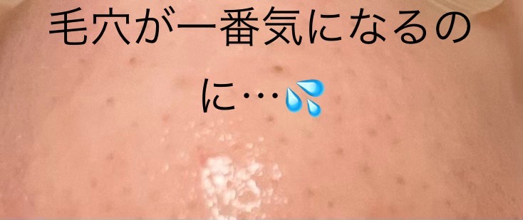 ドラマティカリーディファレント モイスチャライジング ローション プラス/CLINIQUE/乳液を使ったクチコミ（2枚目）