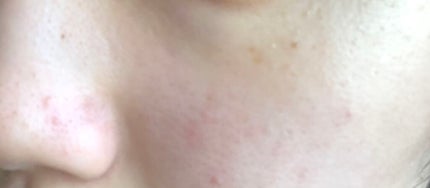 CICA デイリースージングマスク/VT/シートマスク・パックを使ったクチコミ(2枚目)