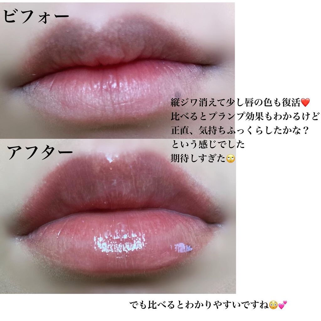 ドトムリッププラスプランパー/keybo/リッププランパーを使ったクチコミ(3枚目)