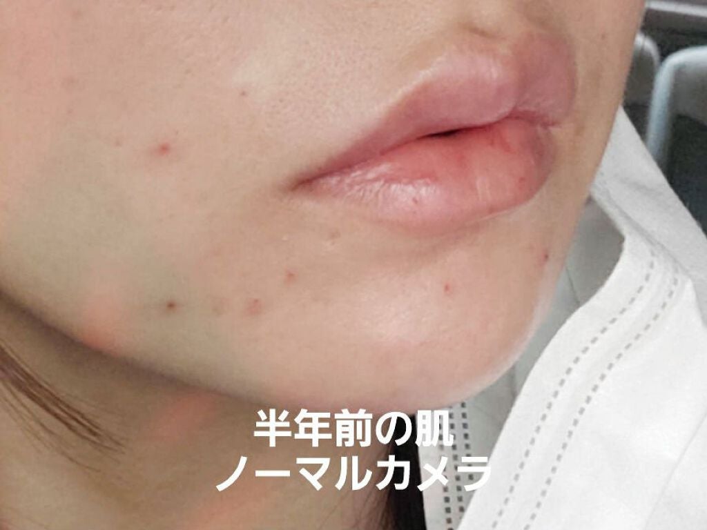 ì€ìâ¡ on LIPS ãðð¡åããããã1幎å
ã§ã®ãŸãšãð¡ð1幎åã®èã»ãããã»ç®èã®..ãïŒ2æç®ïŒ