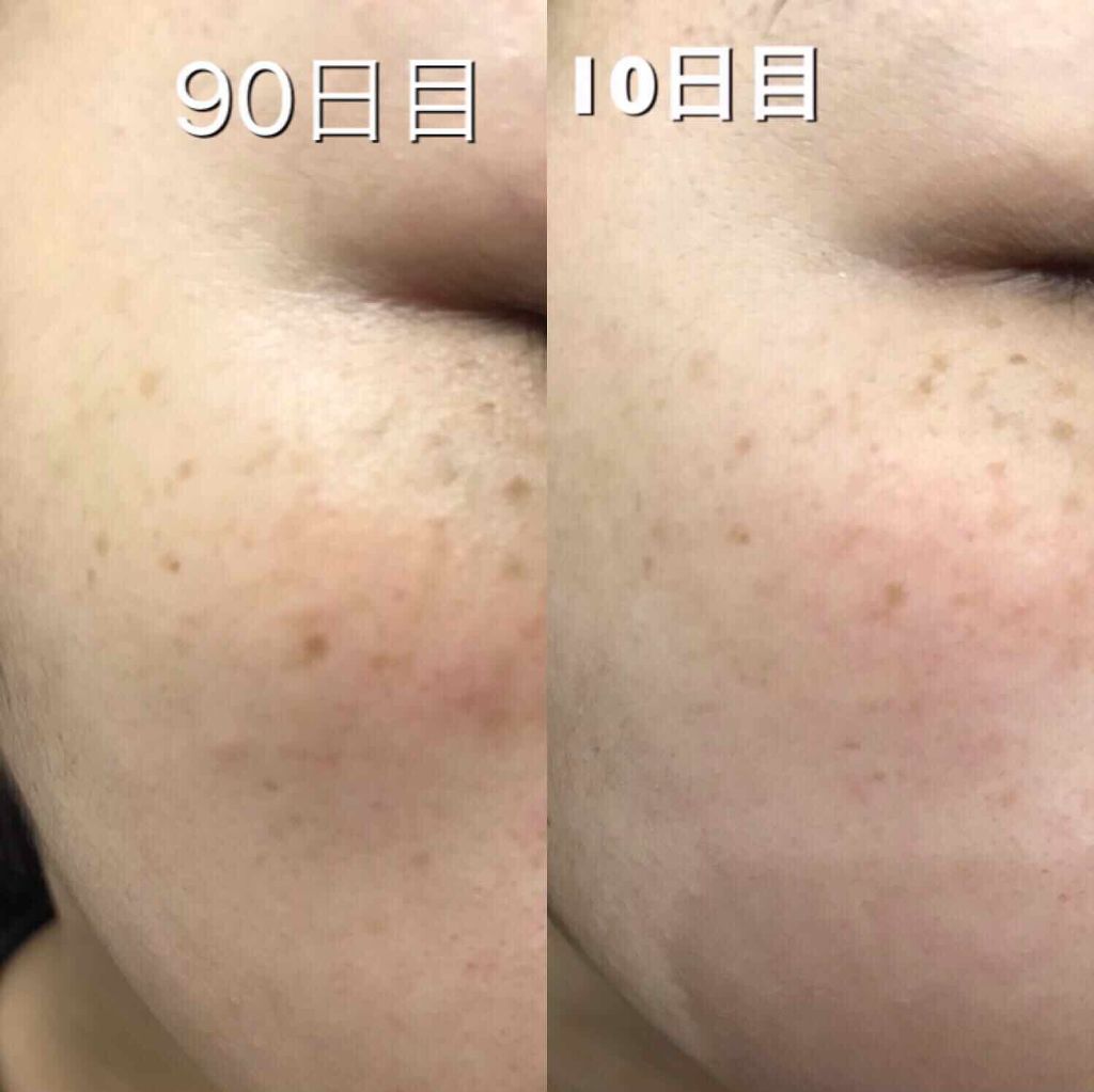 ブライトニングエマルジョン さっぱり/DEW/乳液を使ったクチコミ(2枚目)